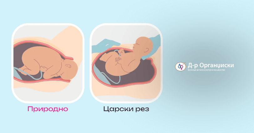 Царски рез vs. Природно породување